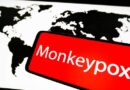 1 confirmed, 6 presumptive monkeypox cases in US, government releasing vaccines for exposed